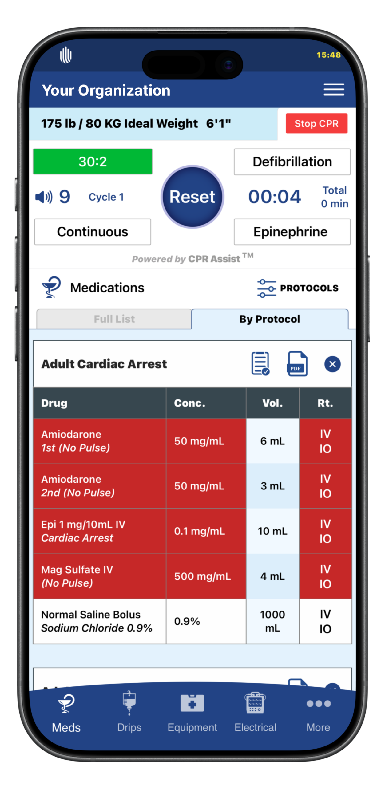 CPR Assist Protocol Filtering
